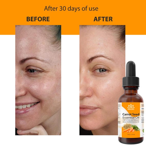 32 Oz 100 Puro Olio Di Semi Neri Egitto Spremuto A Freddo Non Raffinato Olio - Foto 4