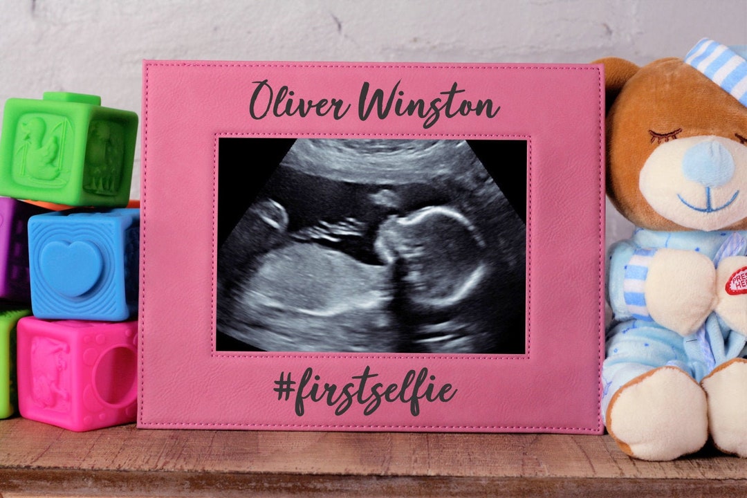 Ultrasound firstselfie Ultrasound Frame New Baby Custom Etsy