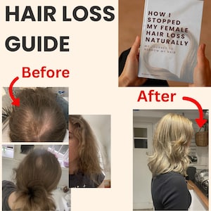 Guia para queda de cabelo feminina: Protocolo de crescimento natural (PDF) *Fotos reais de antes e depois