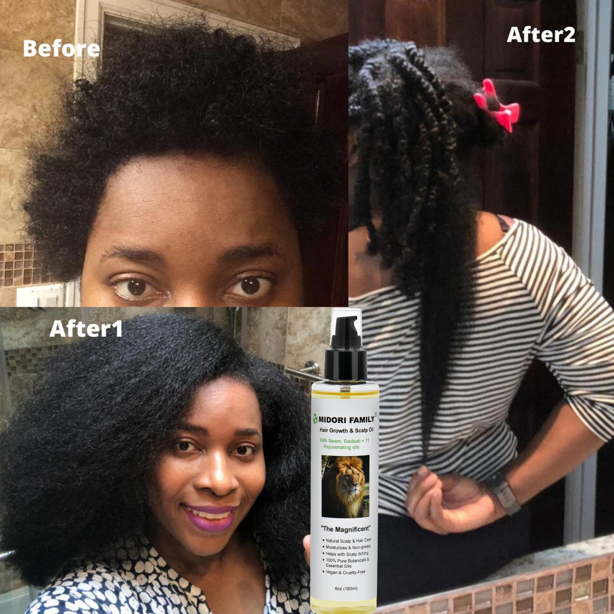 Midori Family Organic Hair Growth Oil Alopecia Hair Loss With Etsy