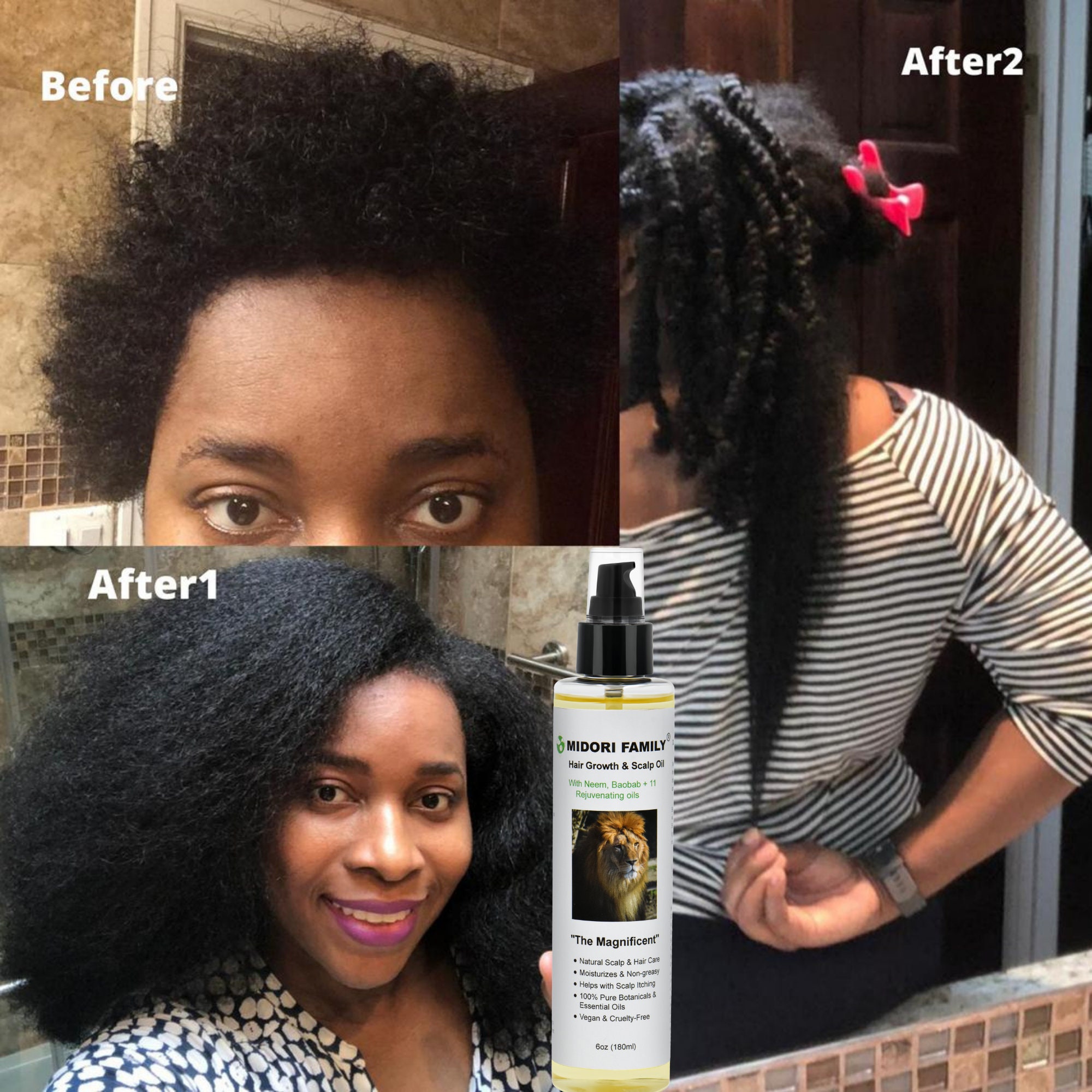 Midori Family Organic Hair Growth Oil Alopecia Hair Loss With Etsy Midori Family Organic Hair Growth Oil Alopecia Hair Loss With Etsy