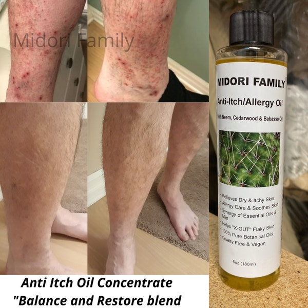 Anti Itch Oil Concentrate- Helps relief scalp itching and skin itching-soothes,restores skin back to normal balance- Mid-Severe Itching