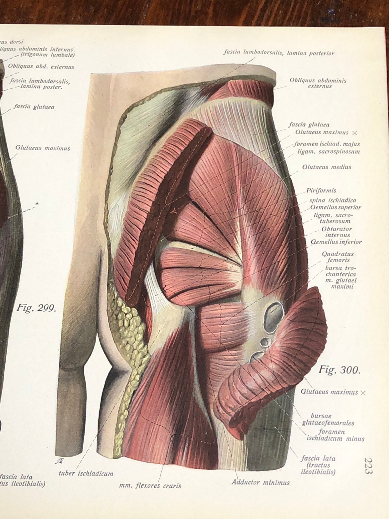 2 Male Abdominal Muscle Anatomy Prints Genuine 1922 | Etsy
