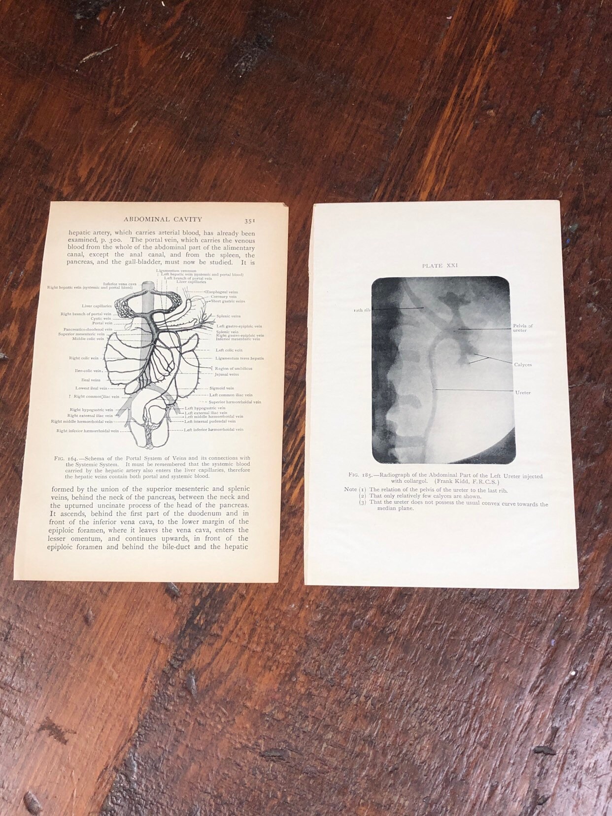 15 Antique Medical Print Set Adominal Cavity Genuine 1927 Etsy