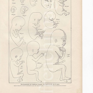Foetus Entwicklung Anatomie Platte Französisch Vintage original Druck 1920 medizinische künstlerische Illustration zu rahmen, Wand-Kunst-Plakat menschliches Baby