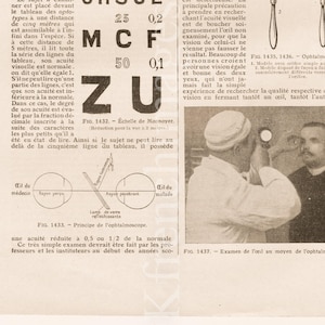Oogheelkunde plaat Franse vintage originele print Medische of nieuwsgierigheid kast illustratie om muur kunst poster medisch oogonderzoek te framen