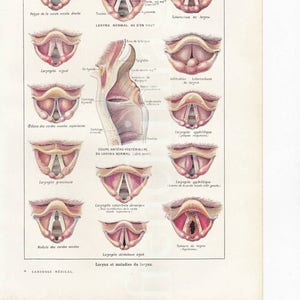 laringe anatomia piastra francese vintage originale stampa 1920 curiosità medica gabinetto illustrazione al telaio, arte della parete voce umana regalo cantante