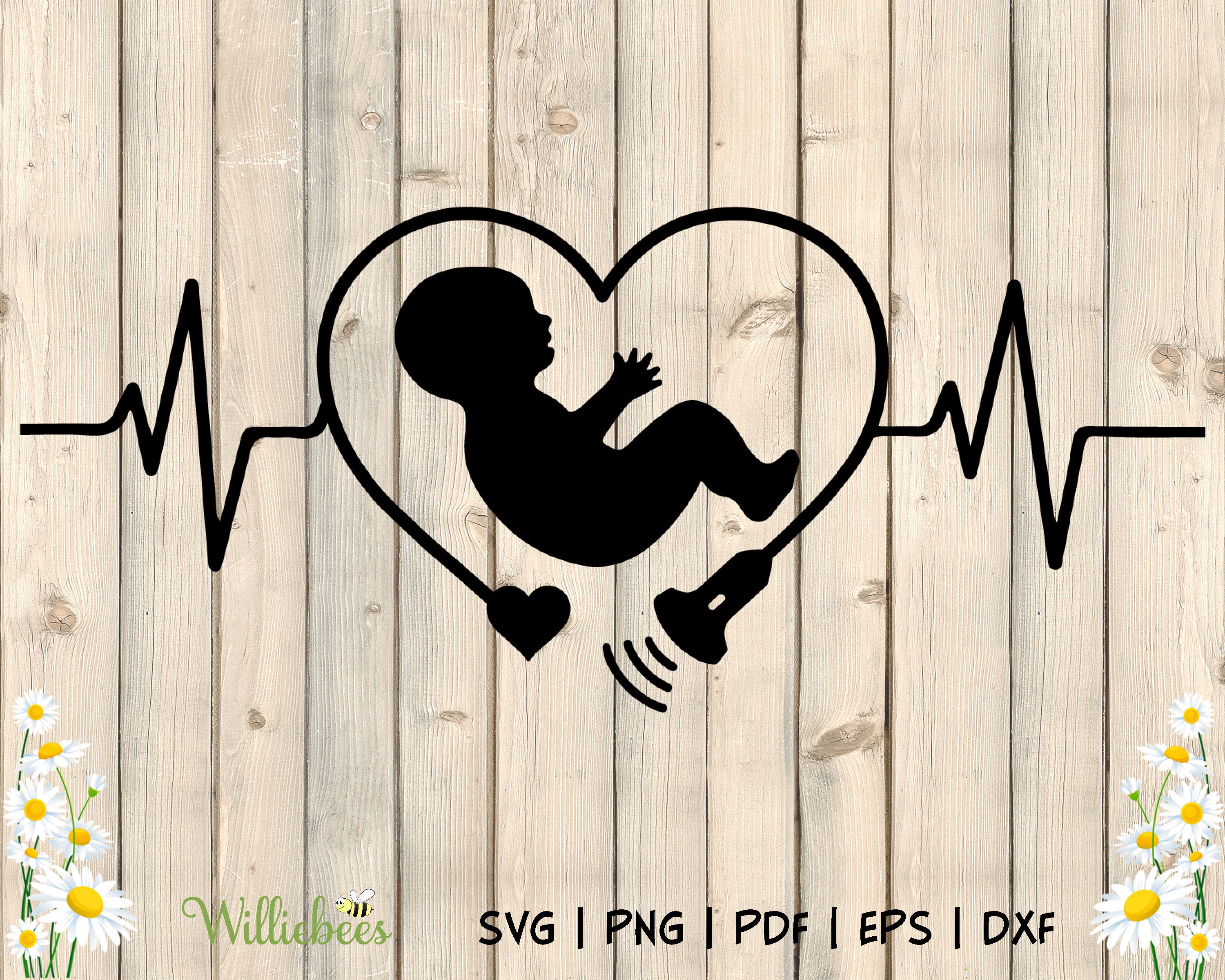 Baby Ultrasound Sonogram SVG Pregnancy and Fertility Fetus Etsy
