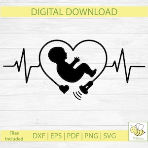 Baby echografie echografie SVG, zwangerschap en vruchtbaarheid, foetus ontwerp, echografie Tech, echografie SVG, echografie sonde, digitale download