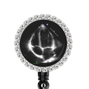 Puede incluir: Una imagen de ultrasonido en blanco y negro de un bebé en un portagafete retráctil plateado y transparente con un adorno de diamantes de imitación.