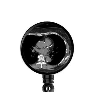 Pode incluir: Um porta-crachá retrátil preto com uma imagem circular clara de uma tomografia computadorizada do tórax. O porta-crachá tem um cordão preto e um clipe prateado. A imagem mostra o coração e os pulmões.