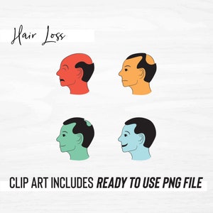 Clipart facial / Pérdida de cabello / Calvicie / Tratamiento de pérdida de cabello / Etapas de la pérdida de cabello / PNG / IMPRIMIBLE