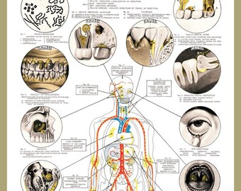 Clark Dental Health Chart 1918 The Progression of Ill Health Teeth Digital Download Vintage Anatomy Dentistry Office