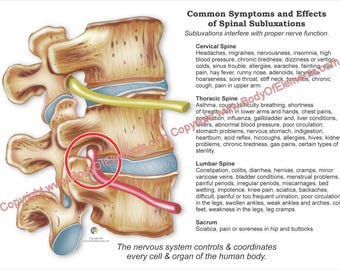 Effects of Spinal Subluxation Chiropractic Poster Handout Digital ...
