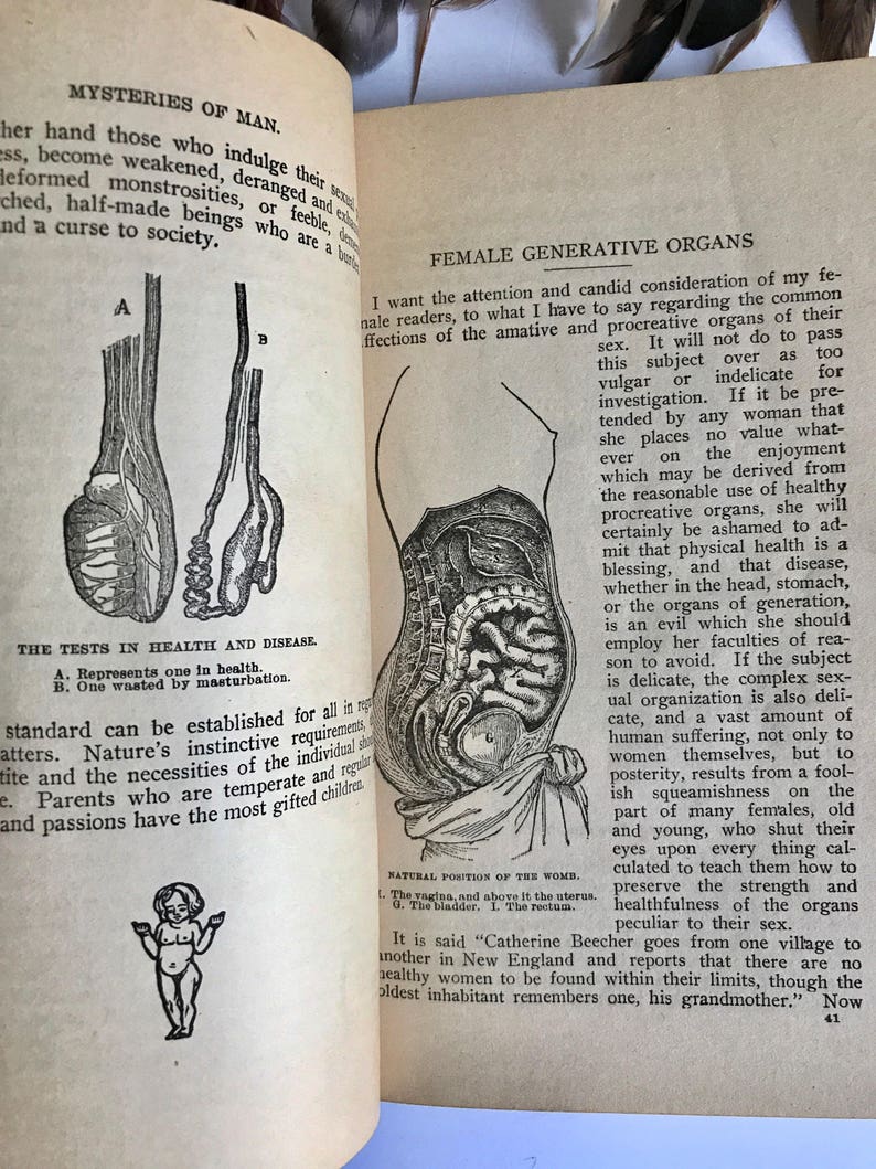 Scarlet fever in the 1920s image