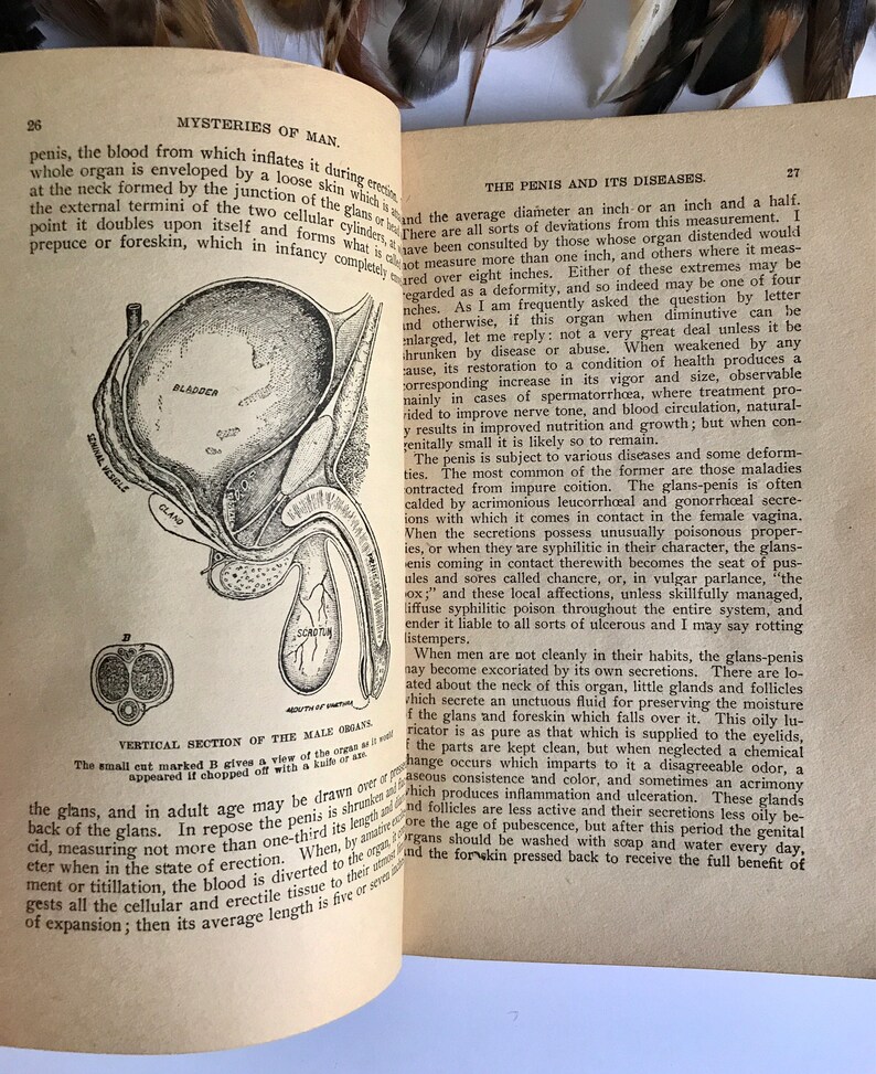 Diseases in the 1930s america picture