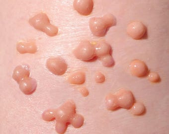 Silicone Boils Cluster Prosthetic – Realistic SFX Skin for Halloween & Film Makeup