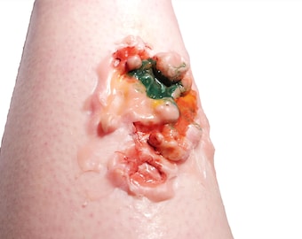 Pre-Painted Silicone Acid Burn Skin Prosthetic – Realistic SFX Wound for Halloween & Film Makeup
