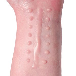 Silicone Suture Scar Prosthetic – Realistic SFX Wound for Halloween & Film Makeup