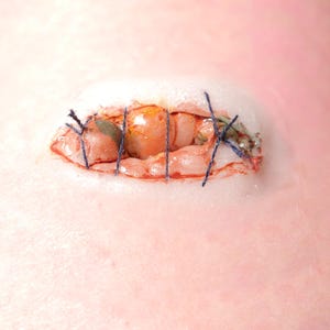 Pre-Painted Silicone Sewn Up Eye Prosthetic – Realistic SFX Wound for Halloween & Film Makeup