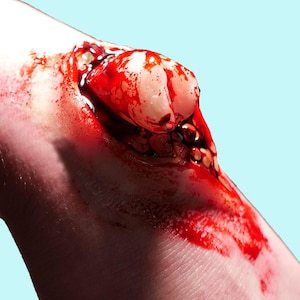 Emerging Broken Bone Prosthetic - Encapsulated Painted Silicone Trauma FX