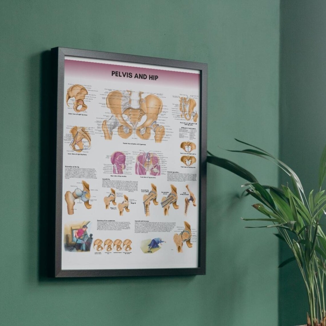 Pelvis Poster Anatomy Human Biology Poster Medical Student Poster Hip