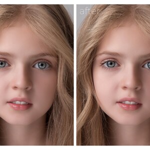 May include: Before and after photos of a young girl's face. The photo on the left shows the girl's face with visible blemishes and imperfections. The photo on the right shows the girl's face with a smooth, flawless complexion.
