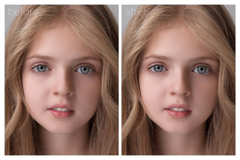 May include: Before and after photos of a young girl's face. The photo on the left shows the girl's face with visible blemishes and imperfections. The photo on the right shows the girl's face with a smooth, flawless complexion.