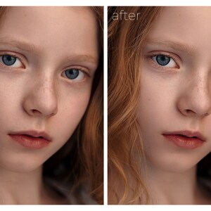 May include: A side-by-side comparison of a young person's face before and after photo editing. The before image shows freckles and natural skin texture. The after image shows smooth, flawless skin.