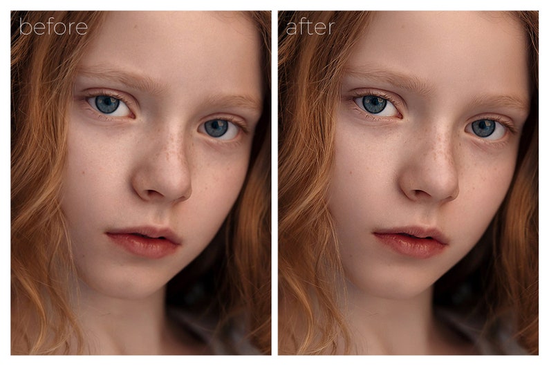 May include: A side-by-side comparison of a young person's face before and after photo editing. The before image shows freckles and natural skin texture. The after image shows smooth, flawless skin.