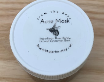 FREE SHIP, Natural Honey Cinnamon Acne Mask: Blemish Treatment