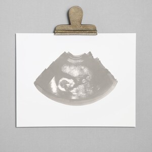 PEWTER Ultrasound, Sonogram, Physical Print