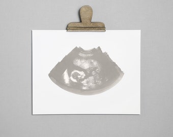 PEWTER Ultrasound, Sonogram, Physical Print