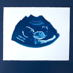 Ultrasound, Sonogram, ORIGINAL Cyanotype Print 8x10 image 2