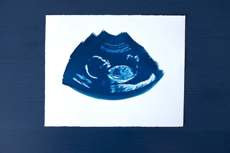 Ultrasound, Sonogram, ORIGINAL Cyanotype Print 8x10 image 2