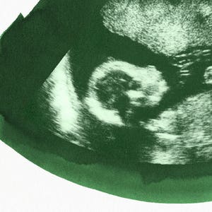 EMERALD Ultrasound, Sonogram, Physical Print image 2