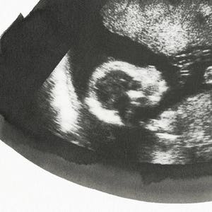 SLATE Ultrasound, Sonogram, Physical Print image 2