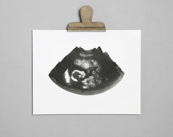 SLATE Ultrasound, Sonogram, Physical Print