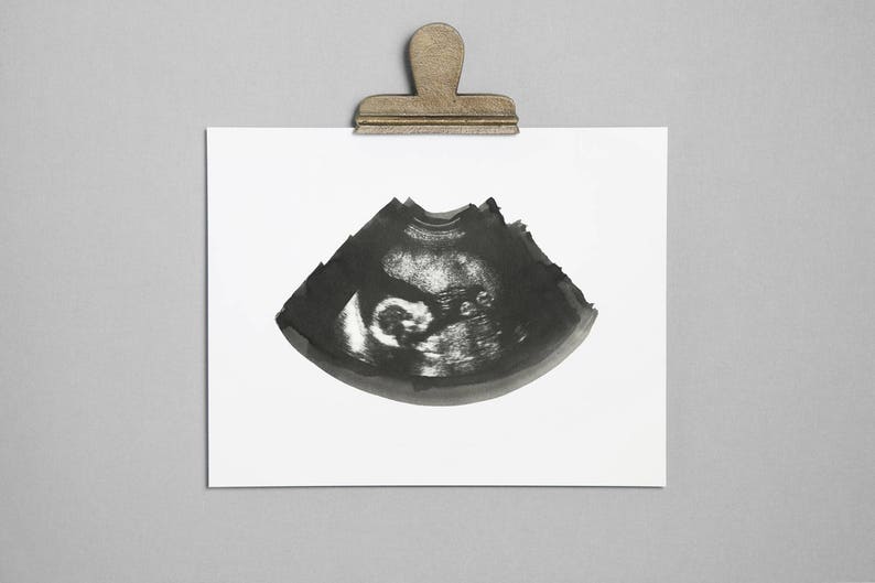 SLATE Ultrasound, Sonogram, Physical Print image 1