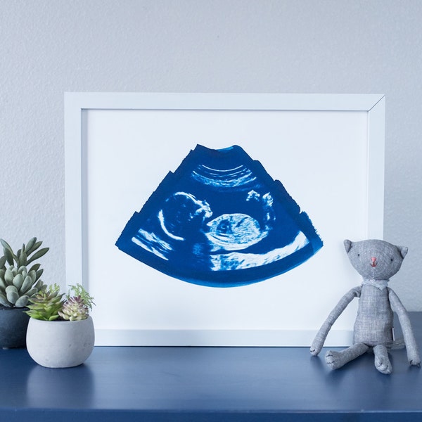 Ultrasound, Sonogram, ORIGINAL Cyanotype Print 11X14