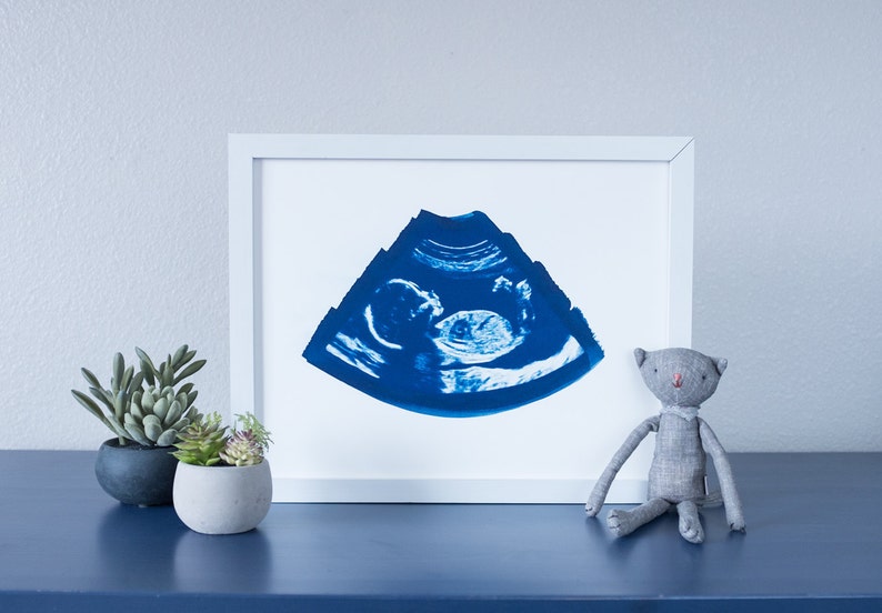 Ultrasound Sonogram ORIGINAL Cyanotype Print 11X14 Etsy