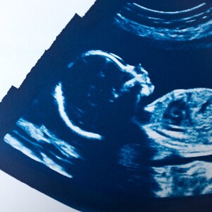 Ultrasound, Sonogram, ORIGINAL Cyanotype Print 8x10 image 3
