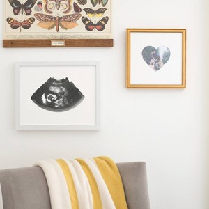 SLATE Ultrasound, Sonogram, Physical Print image 3