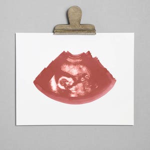 ROSE Ultrasound, Sonogram, Physical Print