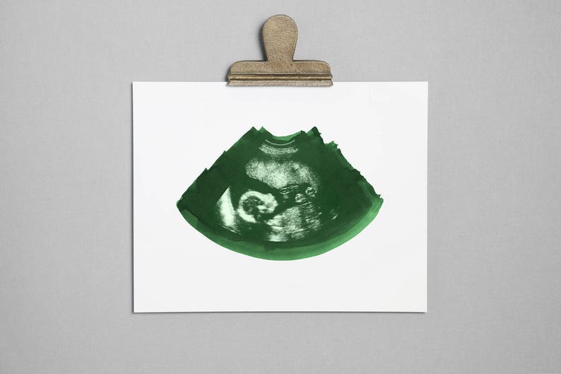 EMERALD Ultrasound, Sonogram, Physical Print image 1