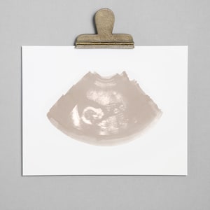 DOVE Ultrasound, Sonogram, Physical Print