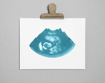 CERULEAN Ultrasound, Sonogram, Physical Print