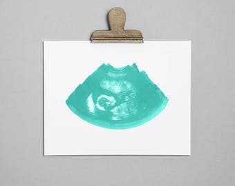 MINT Ultrasound, Sonogram, Physical Print