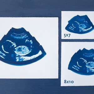 Ultrasound, Sonogram, ORIGINAL Cyanotype Print 8x10 image 4