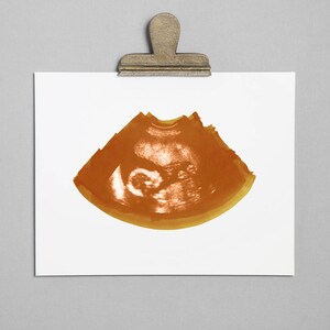 CARAMEL Ultrasound, Sonogram, Physical Print